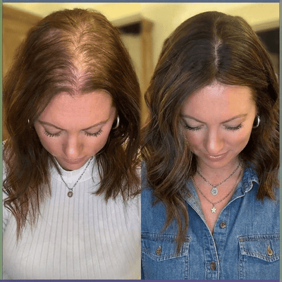 Vitality Essential Supplement Gummies - Vitalune Health